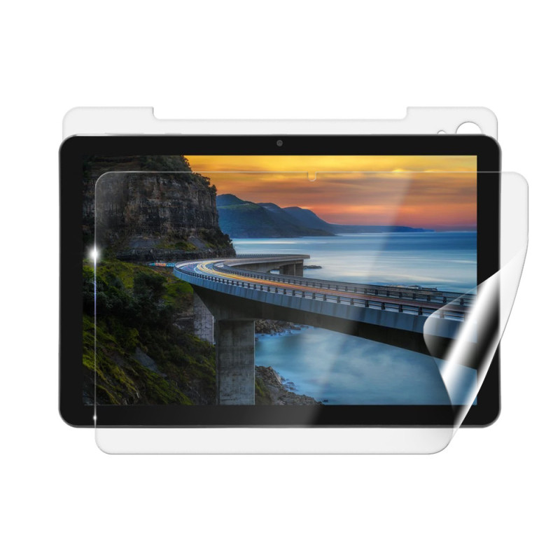 Screenshield IGET Smart W30 fólia na celé telo