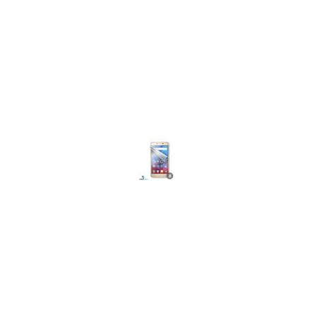 Screenshield™ Lenovo A6020 K5 Plus