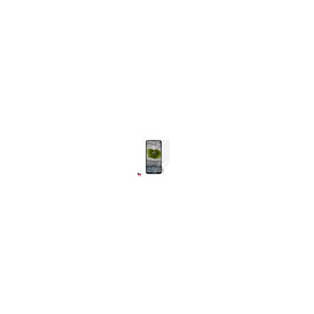 Screenshield NOKIA X10 5G fólia na displej